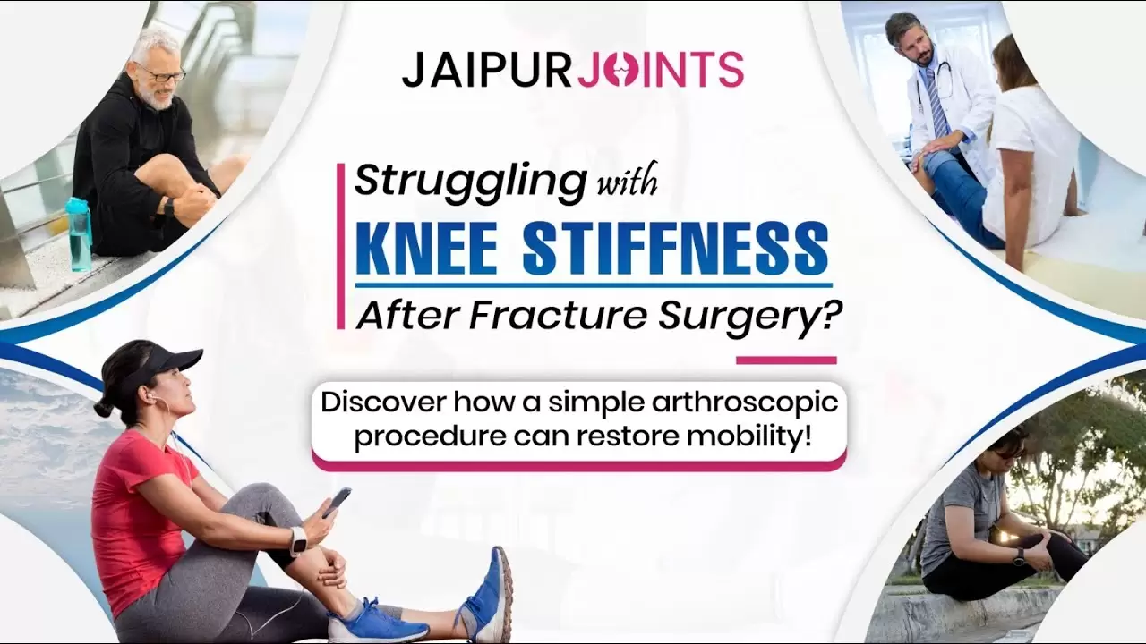 How Arthroscopy Restores Mobility After Fracture Surgery? | Knee Stiffness Treatment & Recovery