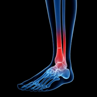 Fracture Treatment​ in Jaipur