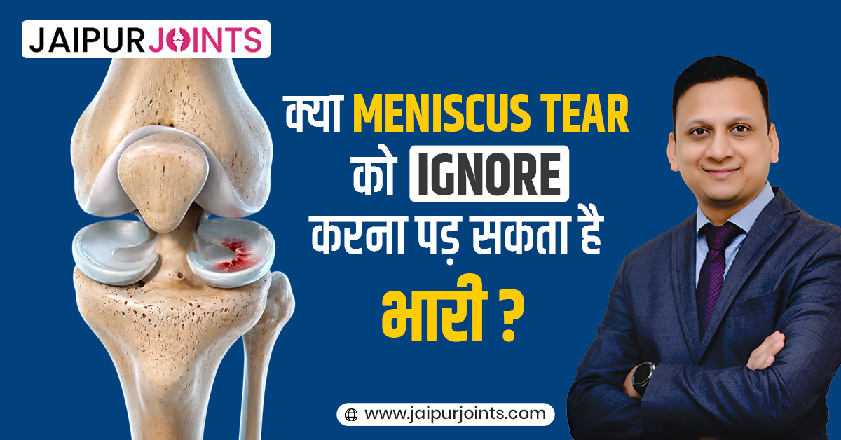 क्या Meniscus Tear को Ignore करना पड़ सकता है भारी?