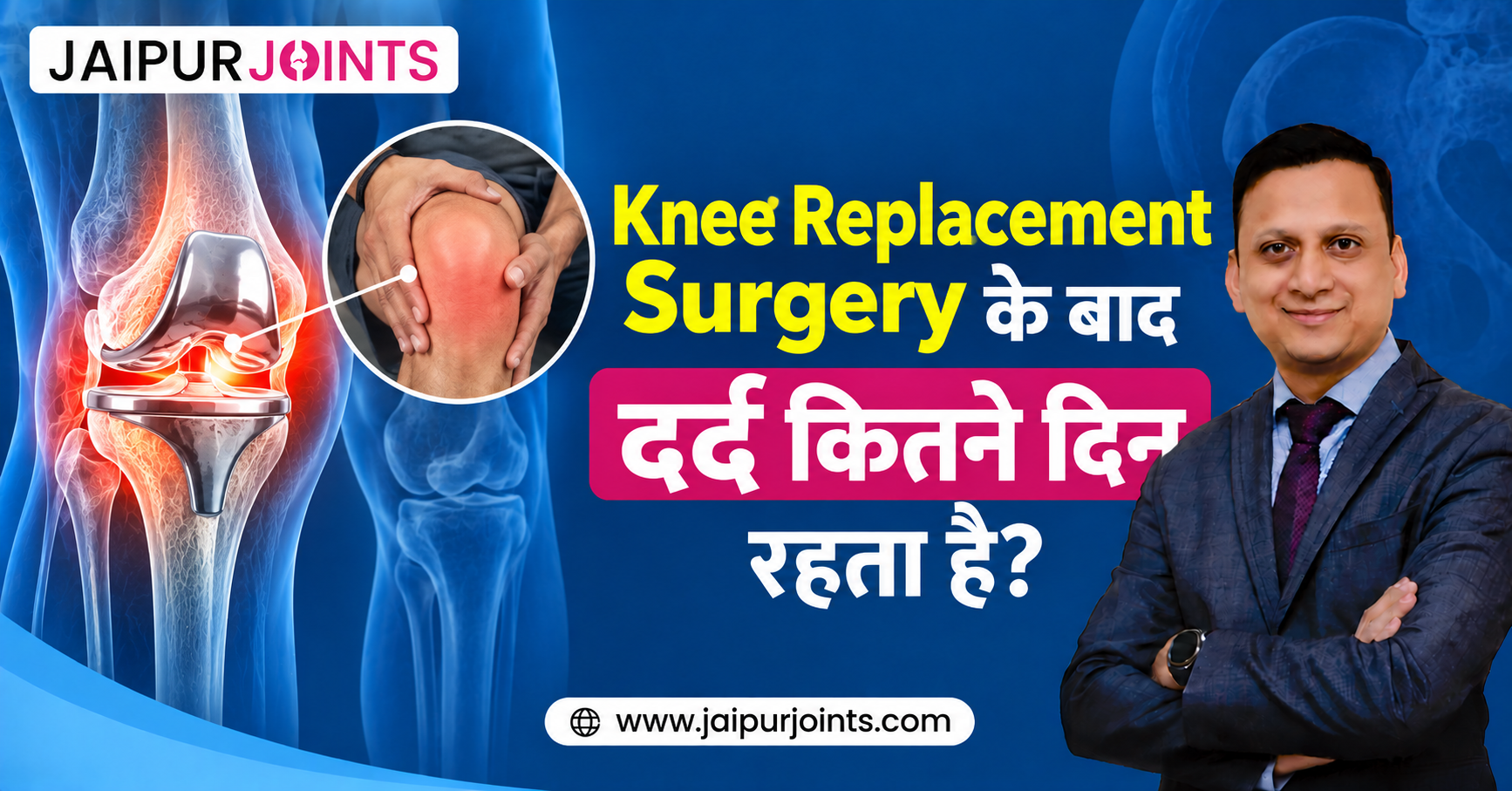 Knee Replacement Surgery के बाद दर्द कितने दिन रहता है?